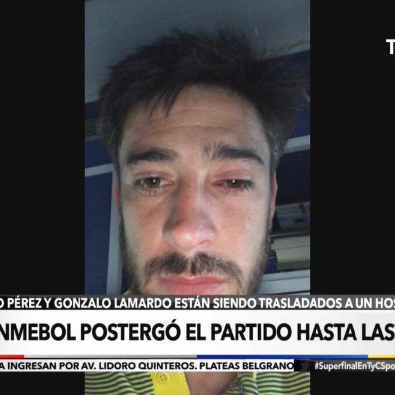 Pobre: foto de la cara de Pablo Pérez después del ataque de los hinchas de River