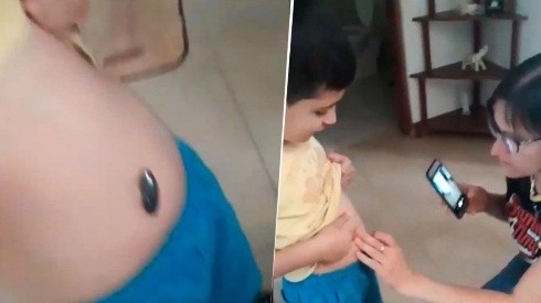 Video viral: nene se tragó un imán y su familia encontró una solución diabólica