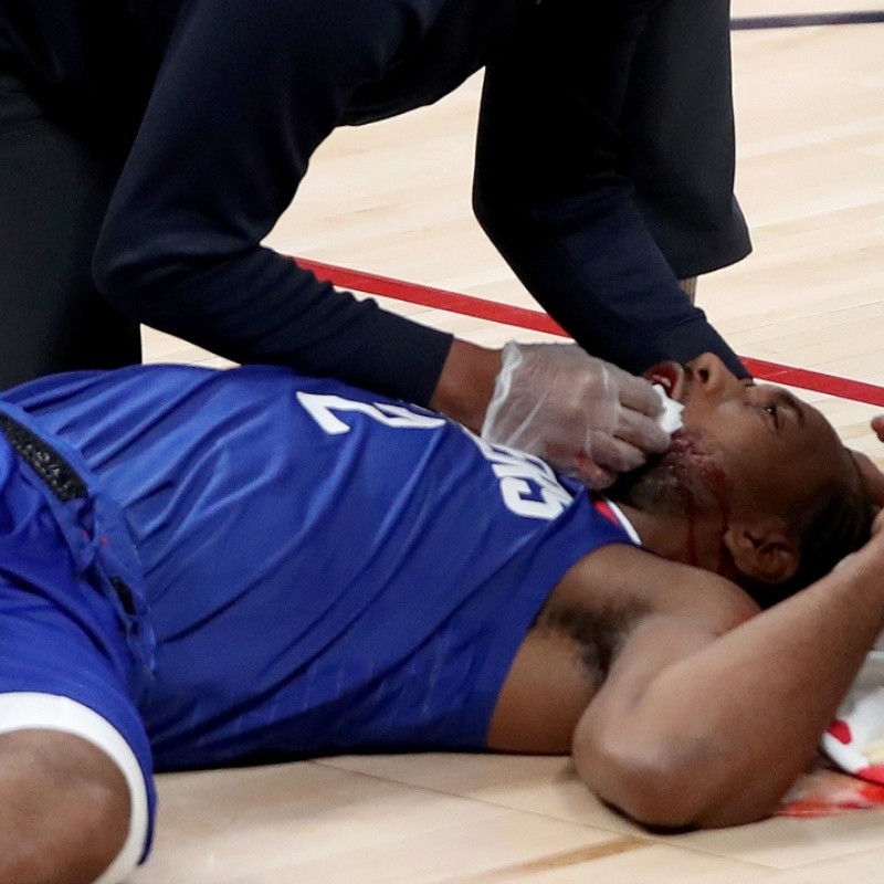 Codazo, sangre y nocaut: el tremendo golpe que recibió Kawhi Leonard