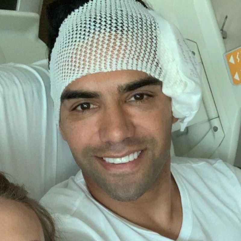 Se conoció la incapacidad que tendrá Falcao García, tras su fractura de cara