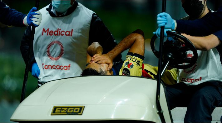 Club América: VIDEO: Chucho López se fractura tras dura ...
