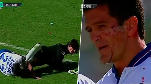 Carlos Hermosillo recibió una brutal patada en la cara en la Final del Invierno de 1997.