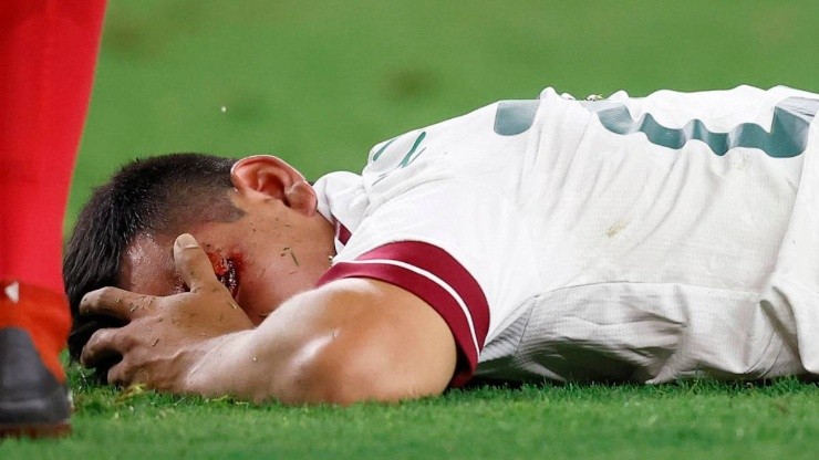 Hirving Lozano fue dado de alta en el hospital. Getty.
