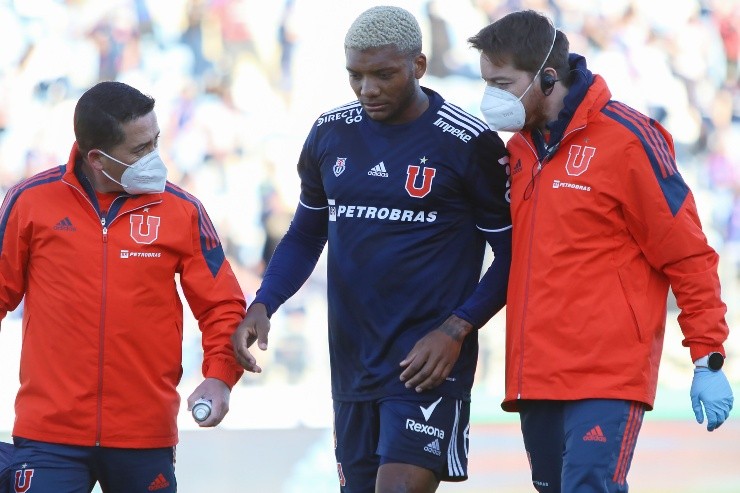 Junior Fernandes Universidad de Chile Lesión