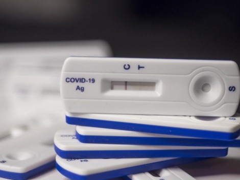 Coronavirus: cuáles son las diferencias entre un PCR y el test de antígenos para confirmar la enfermedad
