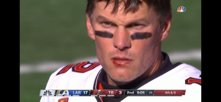 Tom Brady sangrando (Fuente: NBC Sports)