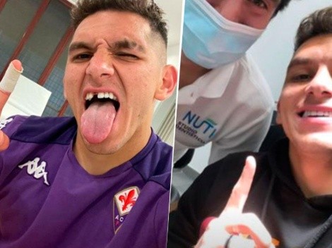 El antes y el después de la caída del diente de Lucas Torreira