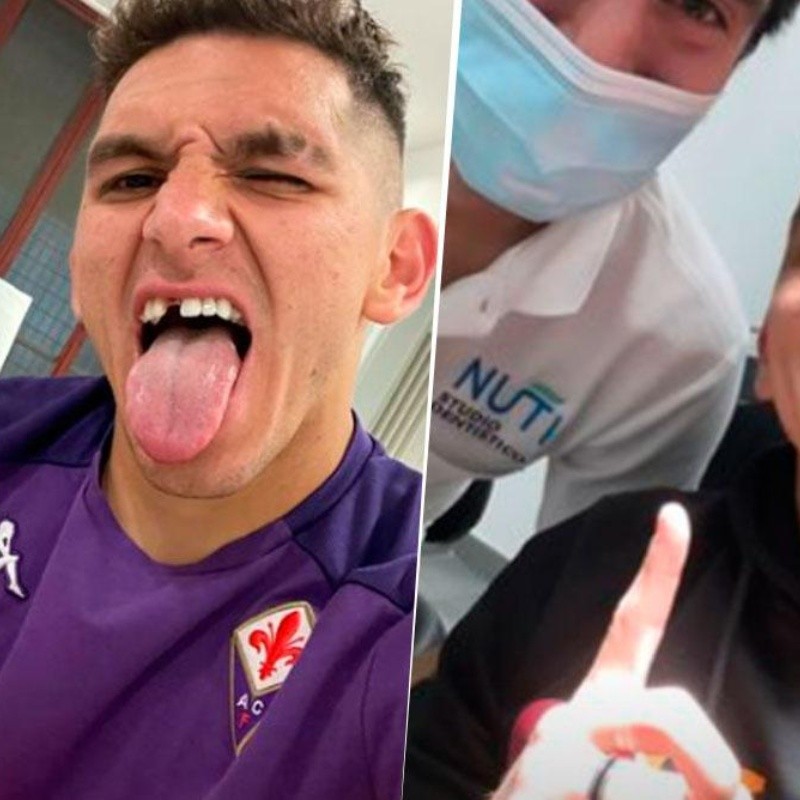 El antes y el después de la caída del diente de Lucas Torreira