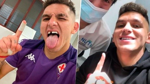 Selfie del antes y después del diente de Torreira.