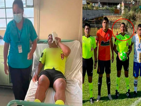 Árbitro de la Copa Perú fue agredido y perdió la vista tras el final del encuentro