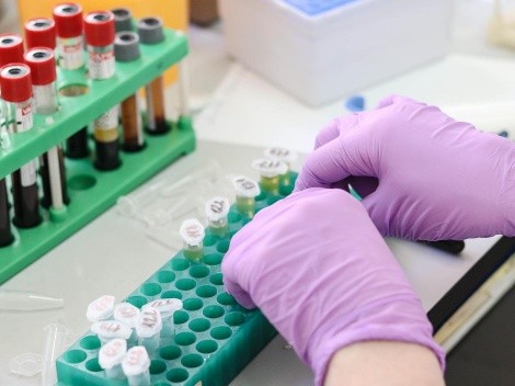 Italiano é a primeira pessoa do mundo a testar positivo para varíola dos macacos, Covid-19 e HIV