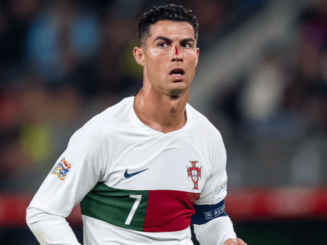 ¿Por qué Cristiano Ronaldo tiene un ojo morado y una herida en la nariz?