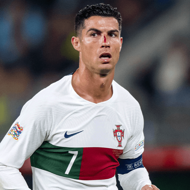 ¿Por qué Cristiano Ronaldo tiene un ojo morado y una herida en la nariz?