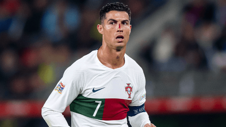 La herida de Cristiano Ronaldo en la nariz y el ojo derecho