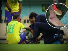 ¡No pinta bien! La foto del tobillo de Neymar que asusta a todo Brasil tras el debut en el Mundial