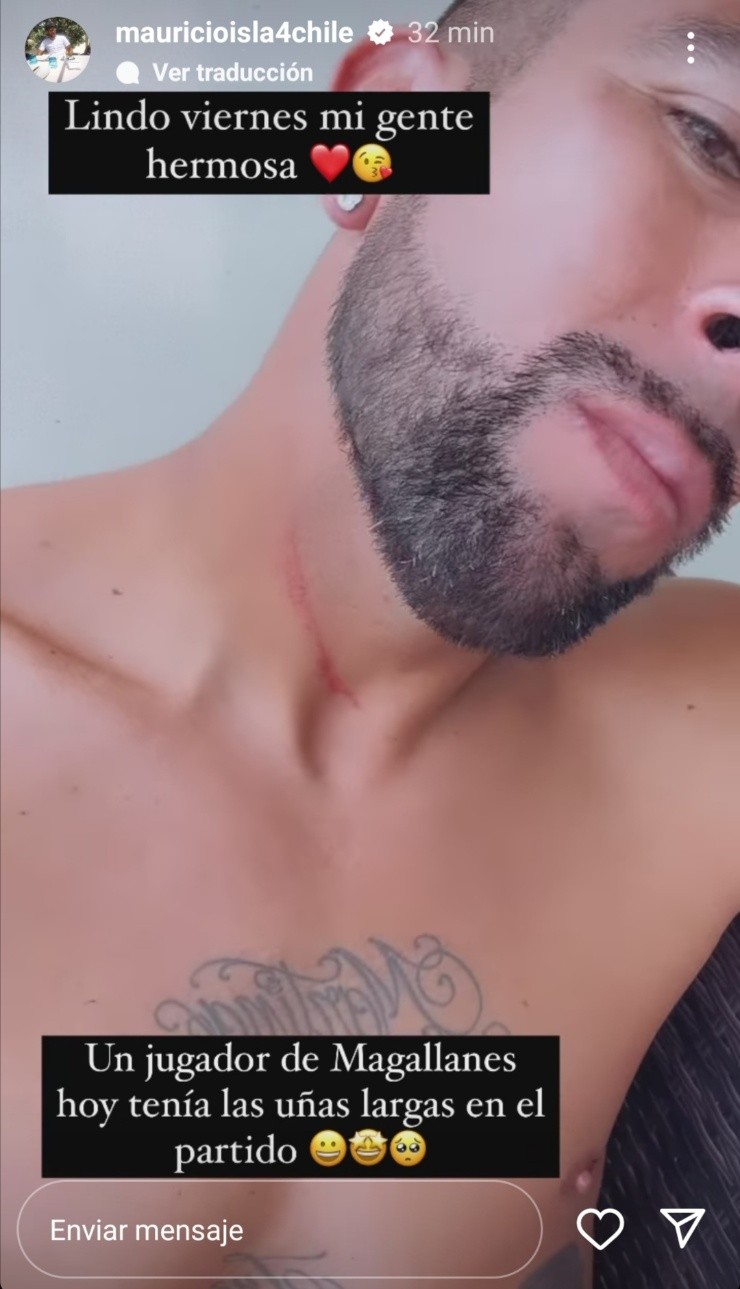 Mauricio Isla Universidad Católica Magallanes Amistoso Rasguño