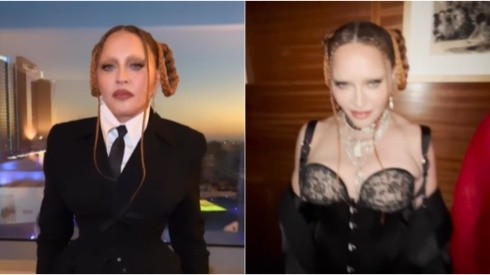 Madonna recebeu críticas pelas supostas mudanças feitas no rosto