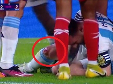 Messi terminó con la rodilla ensangrentada tras recibir fuerte golpe