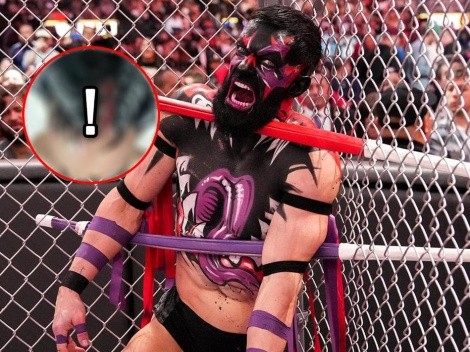 Imágenes sensibles: así quedó la cabeza de Finn Balor luego del combate con Edge en WrestleMania 39