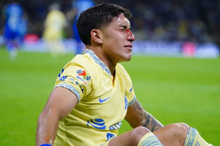 Zendejas sufrió un codazo involuntario por parte de Jesús Gallardo (Imago7)