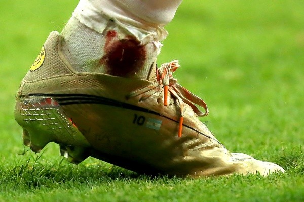 El tobillo de Messi en modo Maradona en Italia ’90. (Foto: Getty)