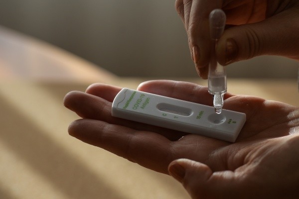 Las farmacias y droguerías son las habilitadas para vender el autotes de covid-19. Fuente: (Getty images)