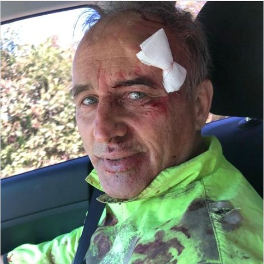 La impactante imagen de Héctor Baldassi tras un serio accidente vial.