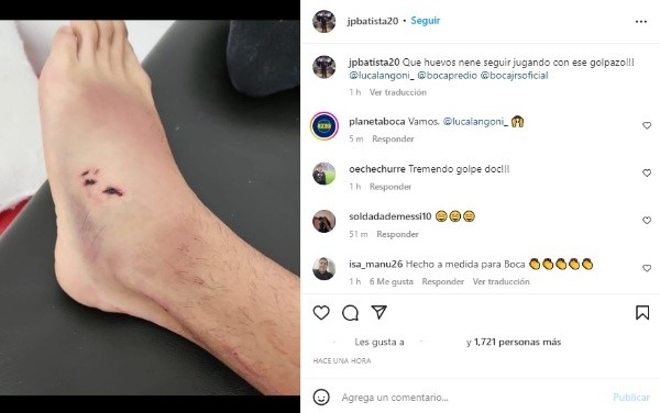 Así quedó el tobillo de Langoni.