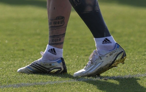 Así está el tobillo de Messi (foto: Getty)