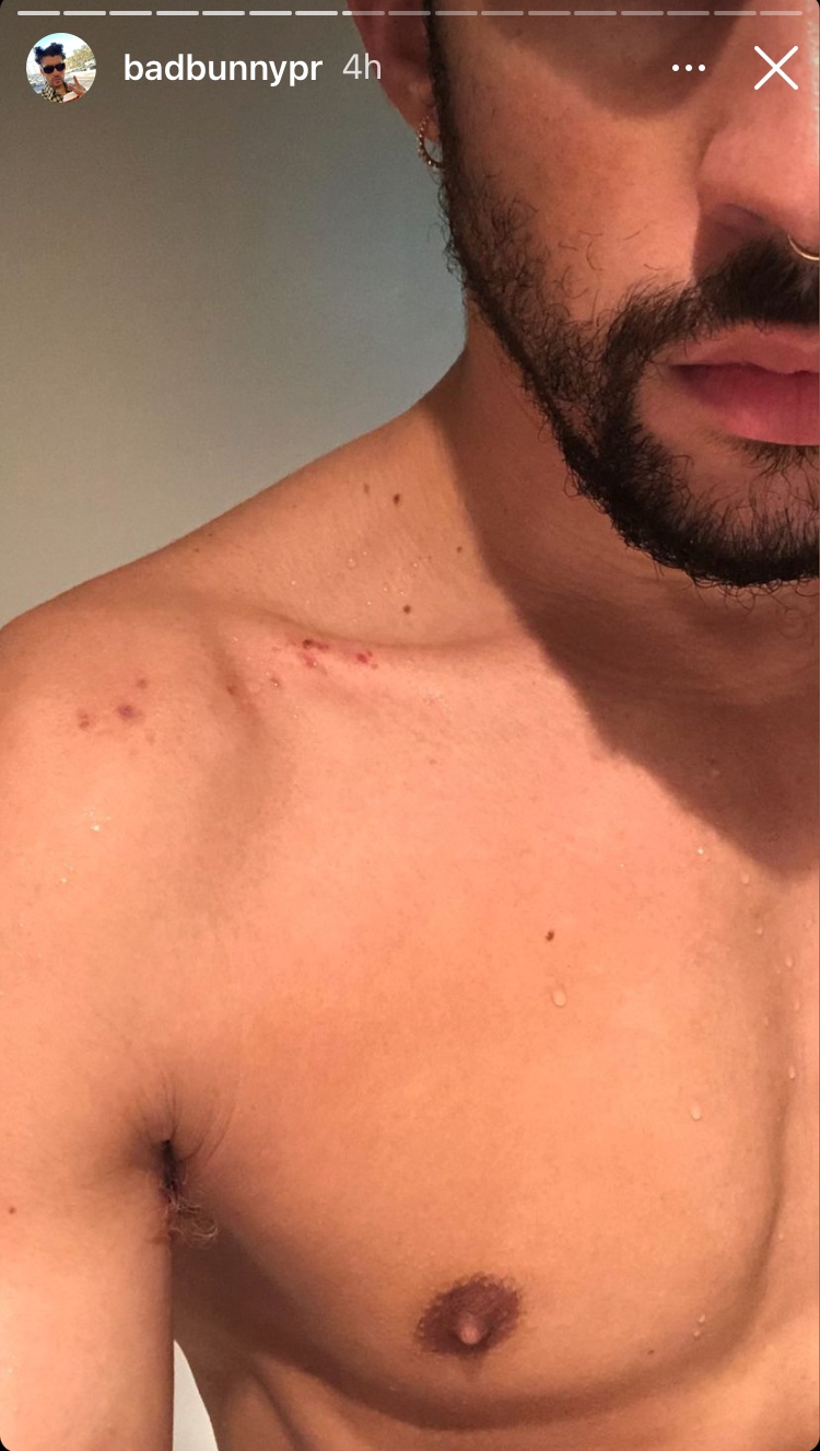Bad Bunny 4