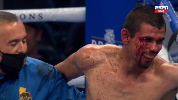 Fundora en Andy Ruiz vs. Chris Arreola