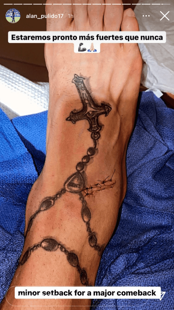 Alan Pulido requirió algunos puntos de sutura en el pie.