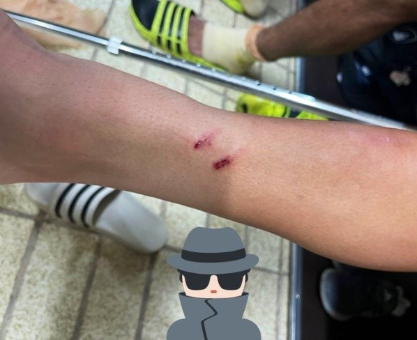 Así quedó la pierna de Marco García tras el Pumas vs. Querétaro por la Liga MX. Francotirador