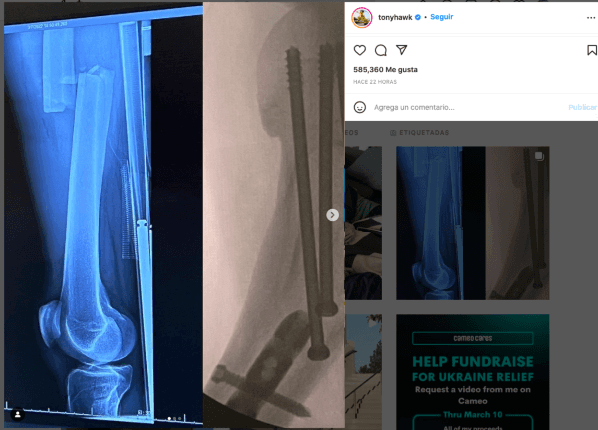 Tony Hawk, Skateboarding Tony Hawk, Skateboarding