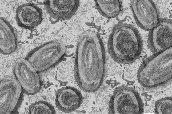 Viruela del mono, virus que preocupa al mundo. Fuente: (Getty images)