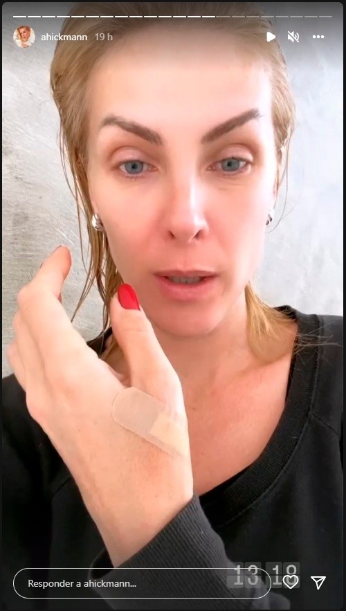 A apresentadora machucou a mão - Imagem: Reprodução/Instagram oficial de Ana Hickmann