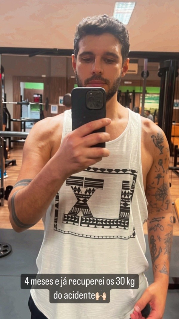 Rodrigo Mussi mostra recuperação 4 meses após acidente - Foto: Instagram