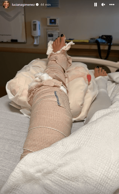 Luciana Gimenez mostra como ficou a perna após acidente - Foto: Instagram @lucianagimenez