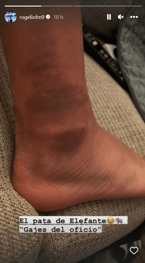 El tobillo de Rogelio.