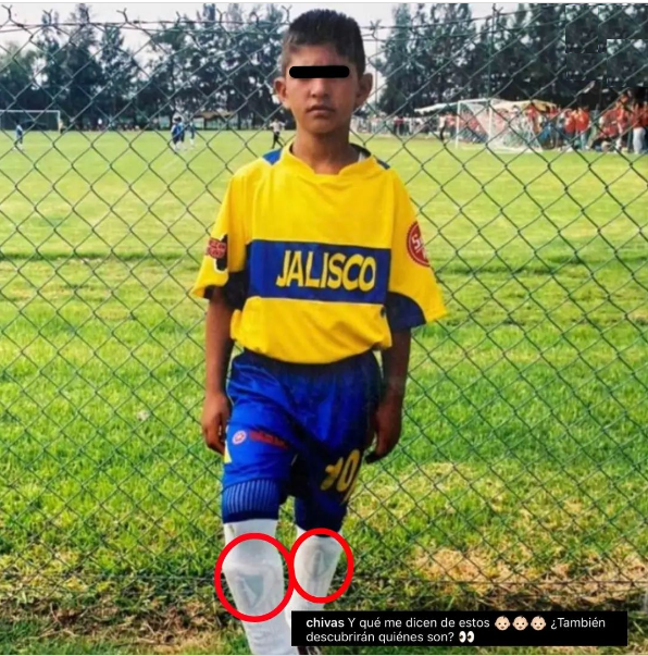 La foto que Chivas publicó de Pocho Guzmán (Chivas)